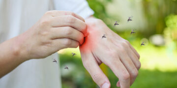 Dengue mosquito Aedes aegypti on human skin